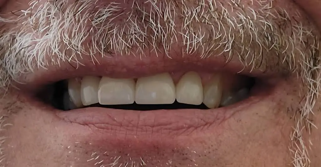 Darby Creek Dental