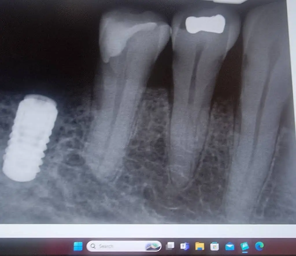 Russell D. Hatfield, DDS, MS, LTD