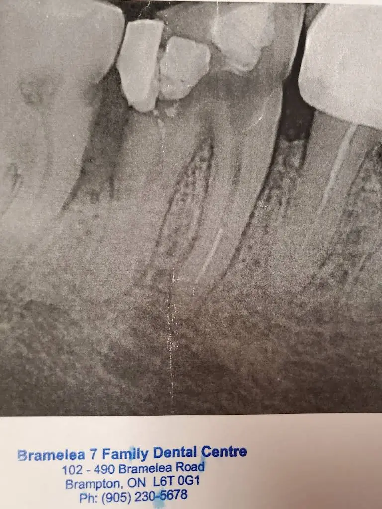 GC Dental