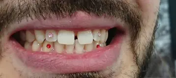 Sorriso Dental Care