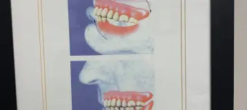 Caledon Denture Clinic