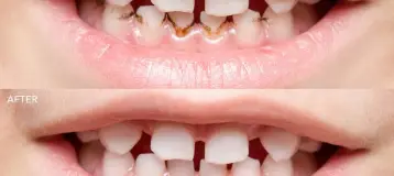 West Vaughan Dental