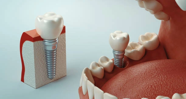 West Vaughan Dental
