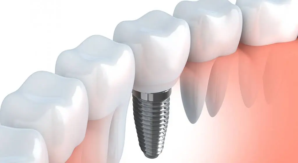 West Vaughan Dental