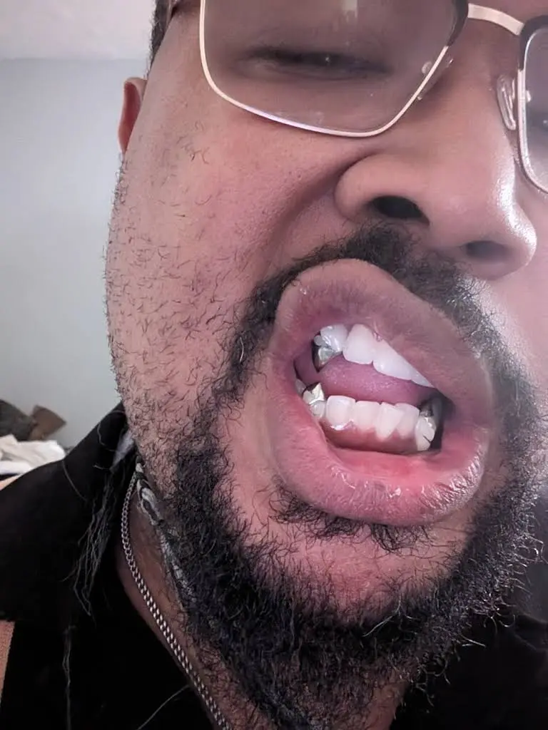 Blue Tooth Dental
