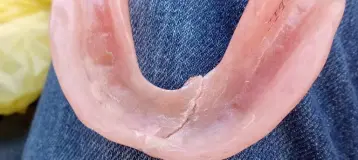 Affordable Dentures & Implants