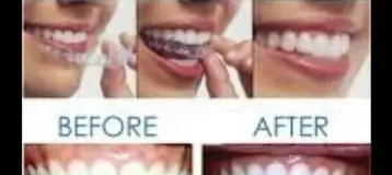 Nanwood Dental