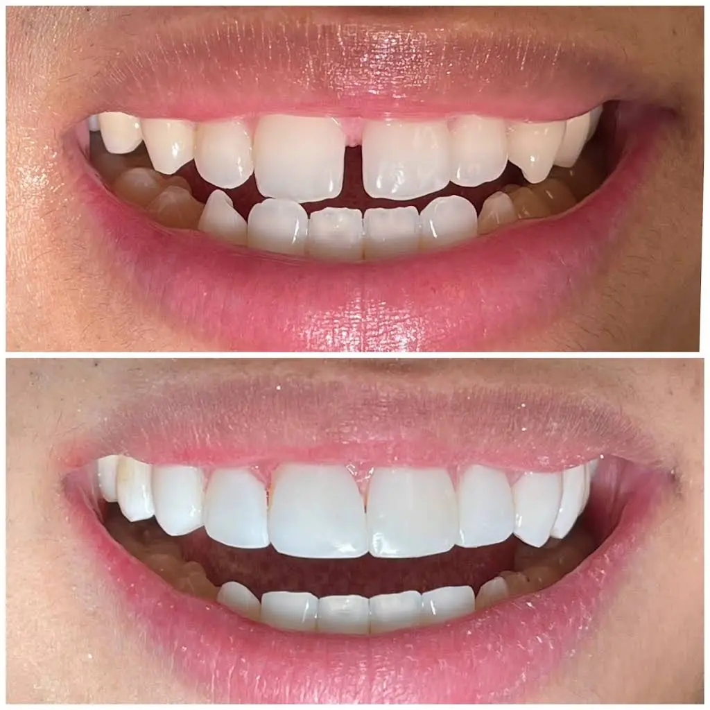Keele Dental Care