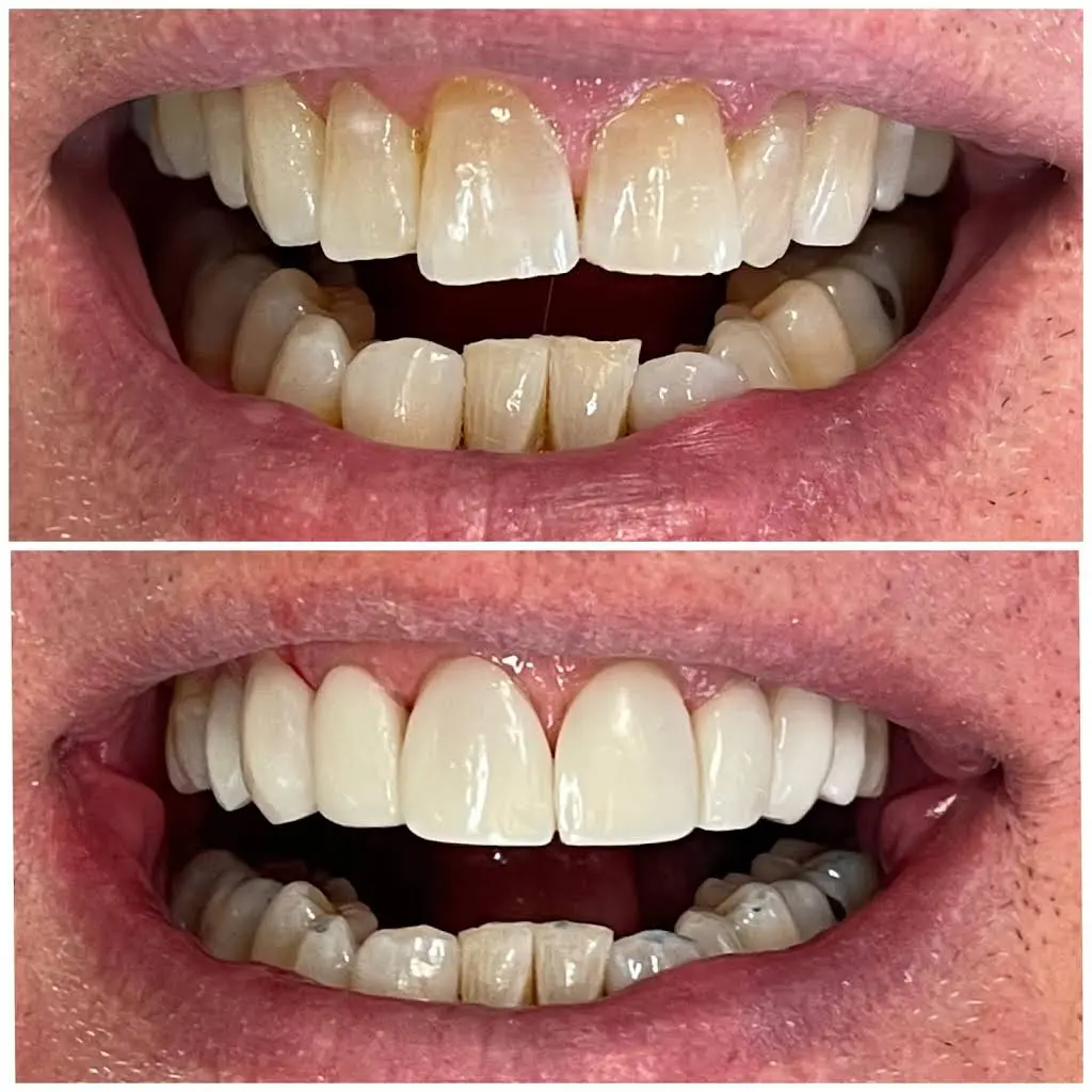 Keele Dental Care