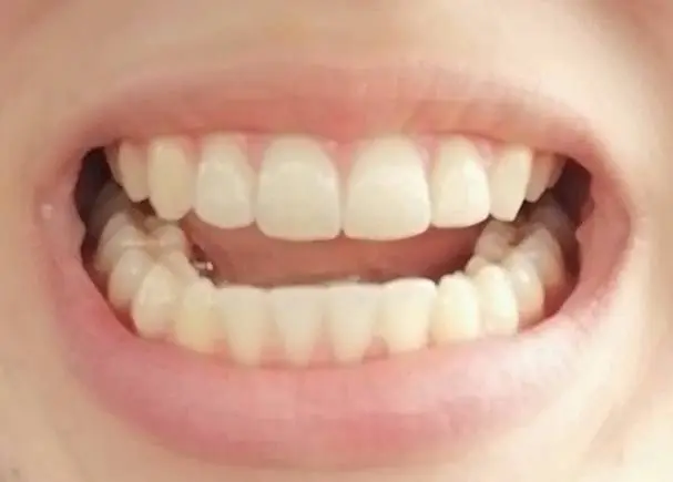 Prism Dental