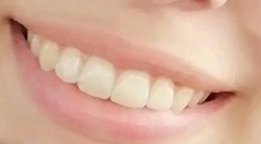 Prism Dental