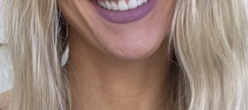 Great Lakes Family Dental Group - Indianapolis