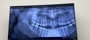 Total Smile Dentistry