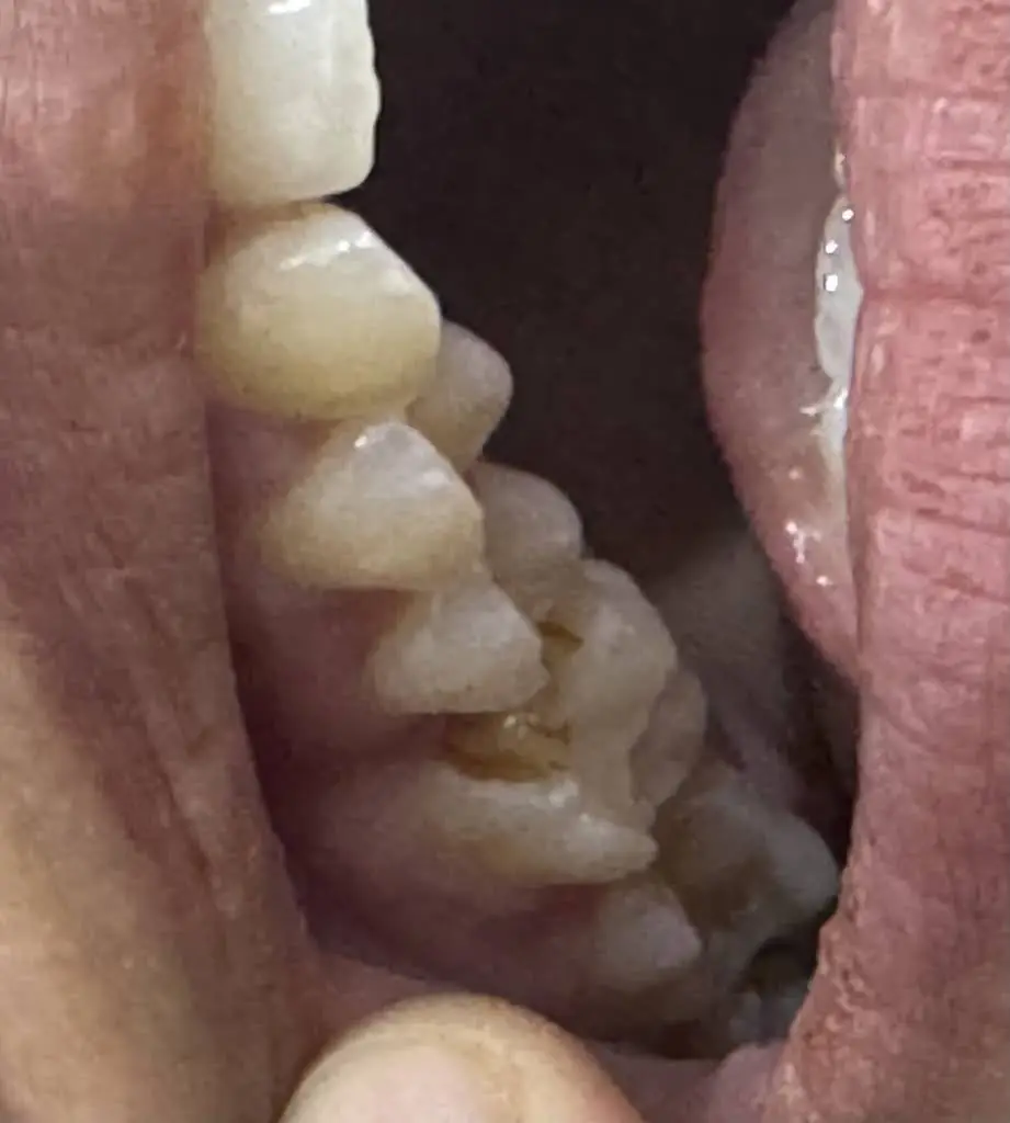 Dr. Harmandeep Raheja Dentistry