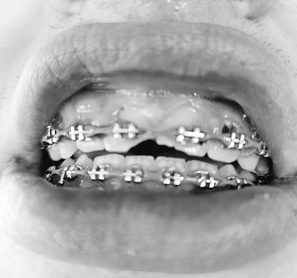 TS Dental