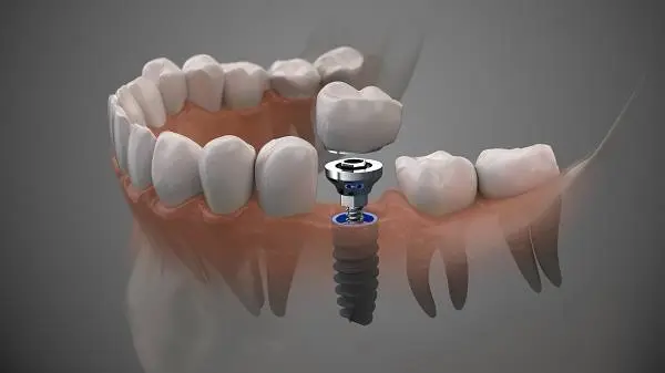 Molson Park Dental