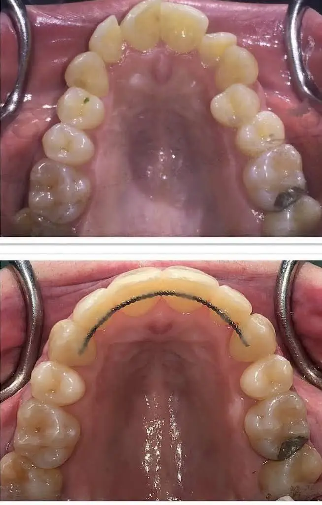 iDent Dental