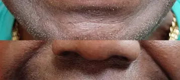Happy Smile Denture Clinic