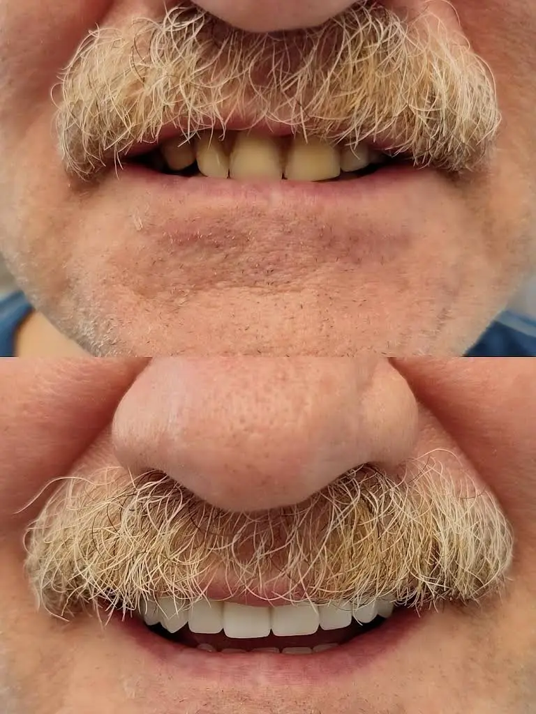 Happy Smile Denture Clinic