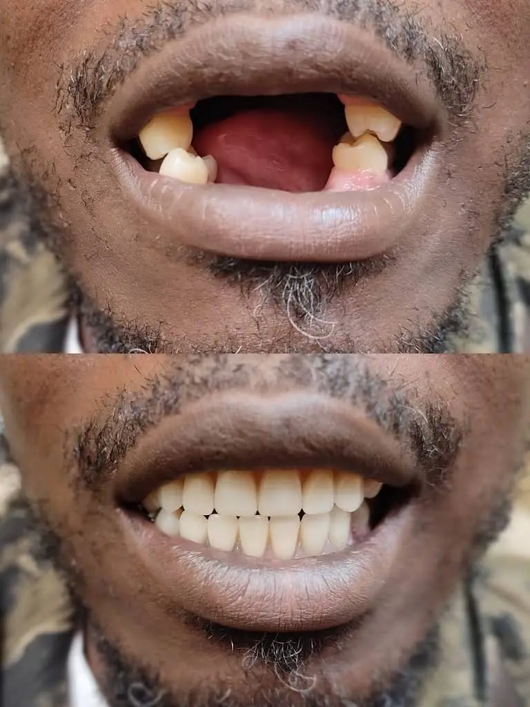 Happy Smile Denture Clinic