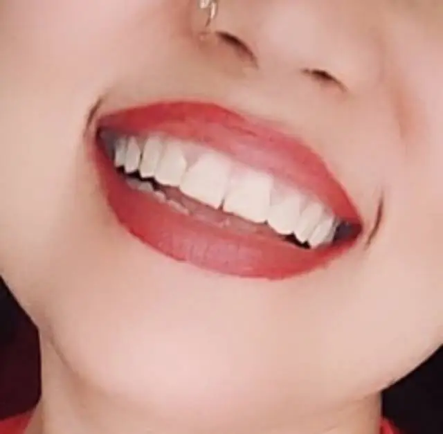 Bramalea Smiles Dentistry