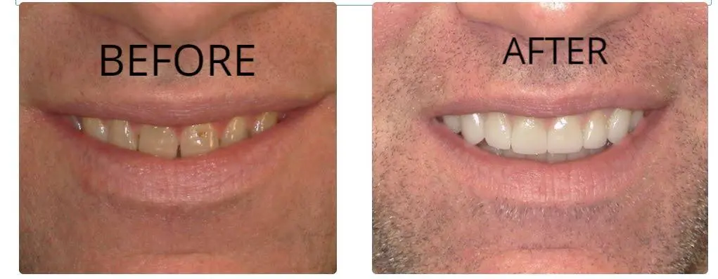 Indy Dental Health