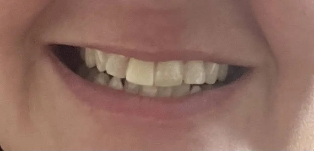 Tenth Street Family Dental