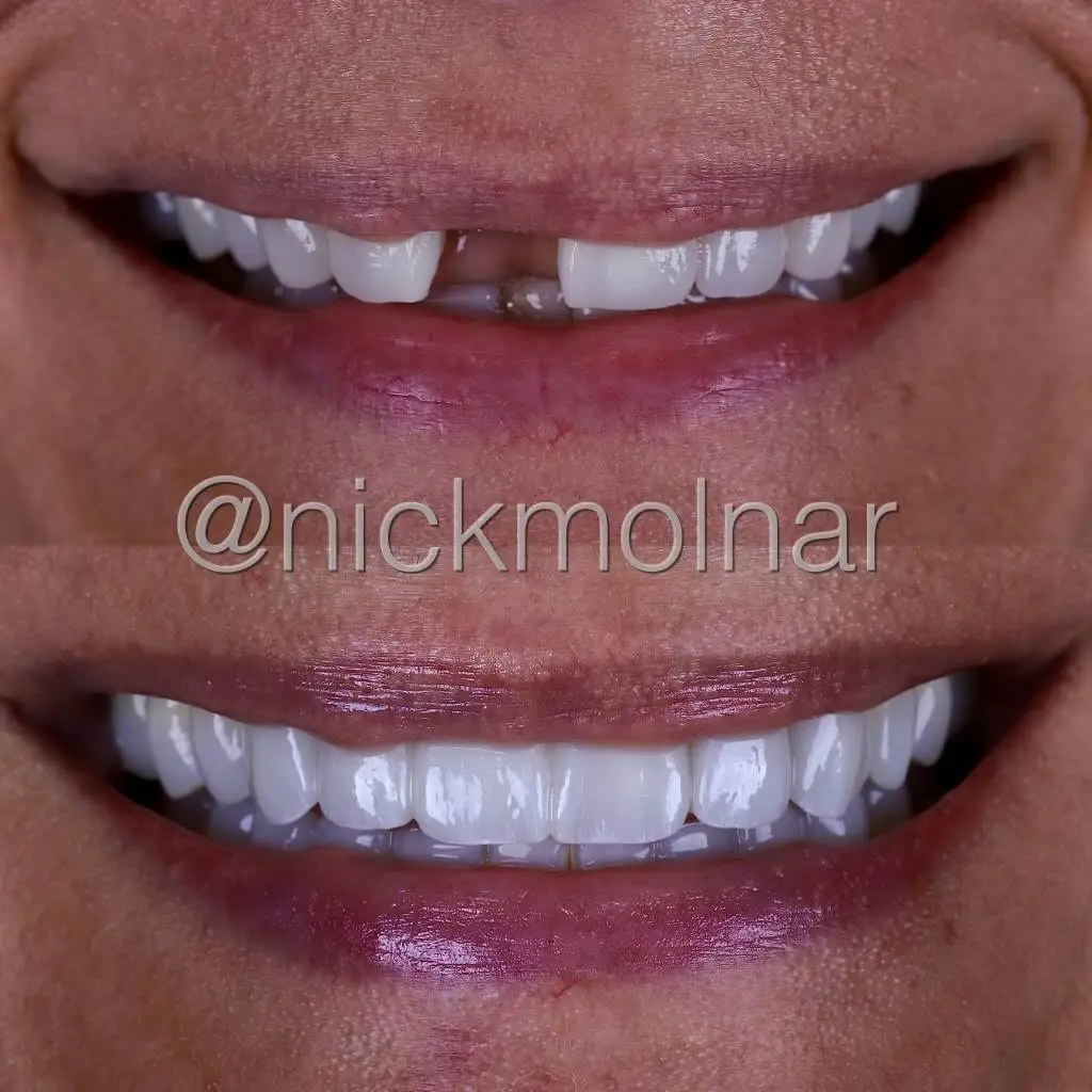 Molnar + Skasko Family and Cosmetic Dentistry