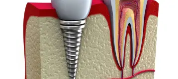 Sandalwood Dental