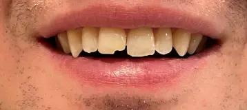 Emergency Dental