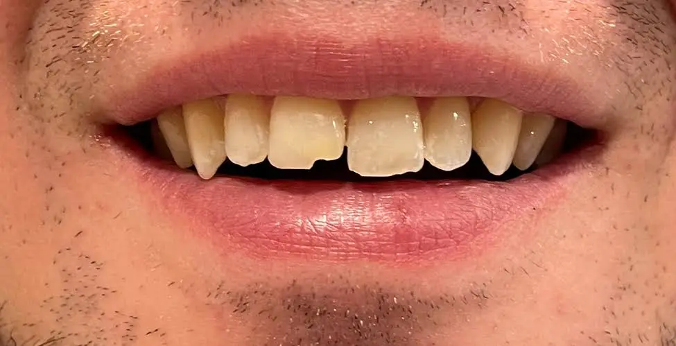 Emergency Dental