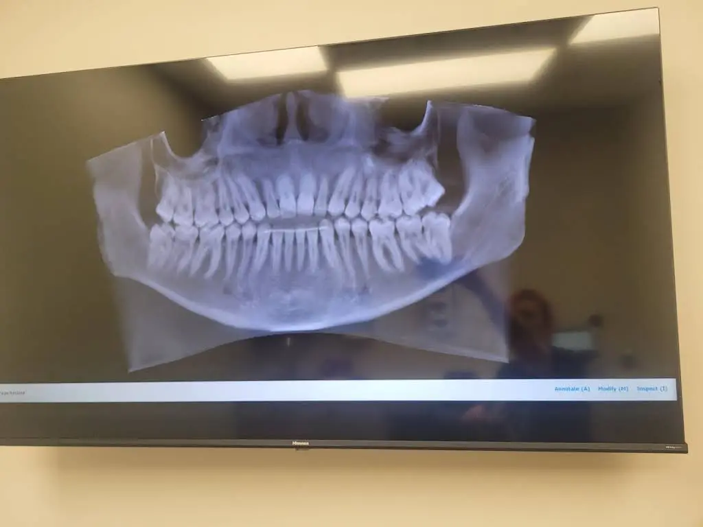 Emergency Dental