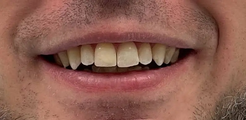 Emergency Dental