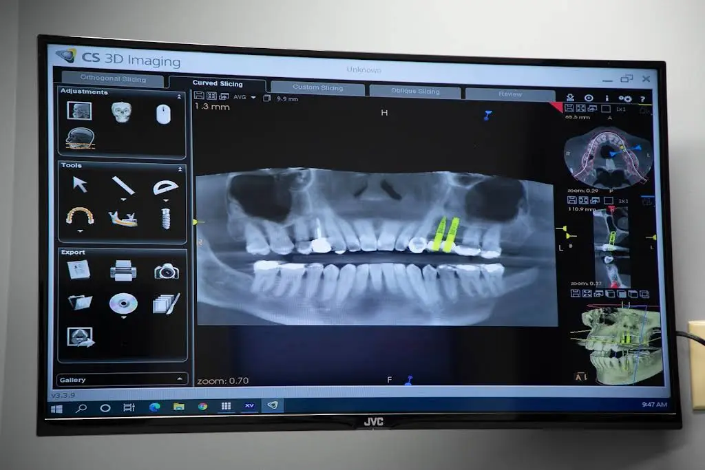 Implant Dentistry and Periodontics - Indianapolis