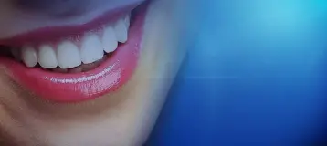Carmel Smiles