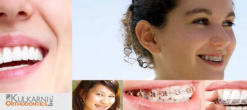 Kulkarni Orthodontics