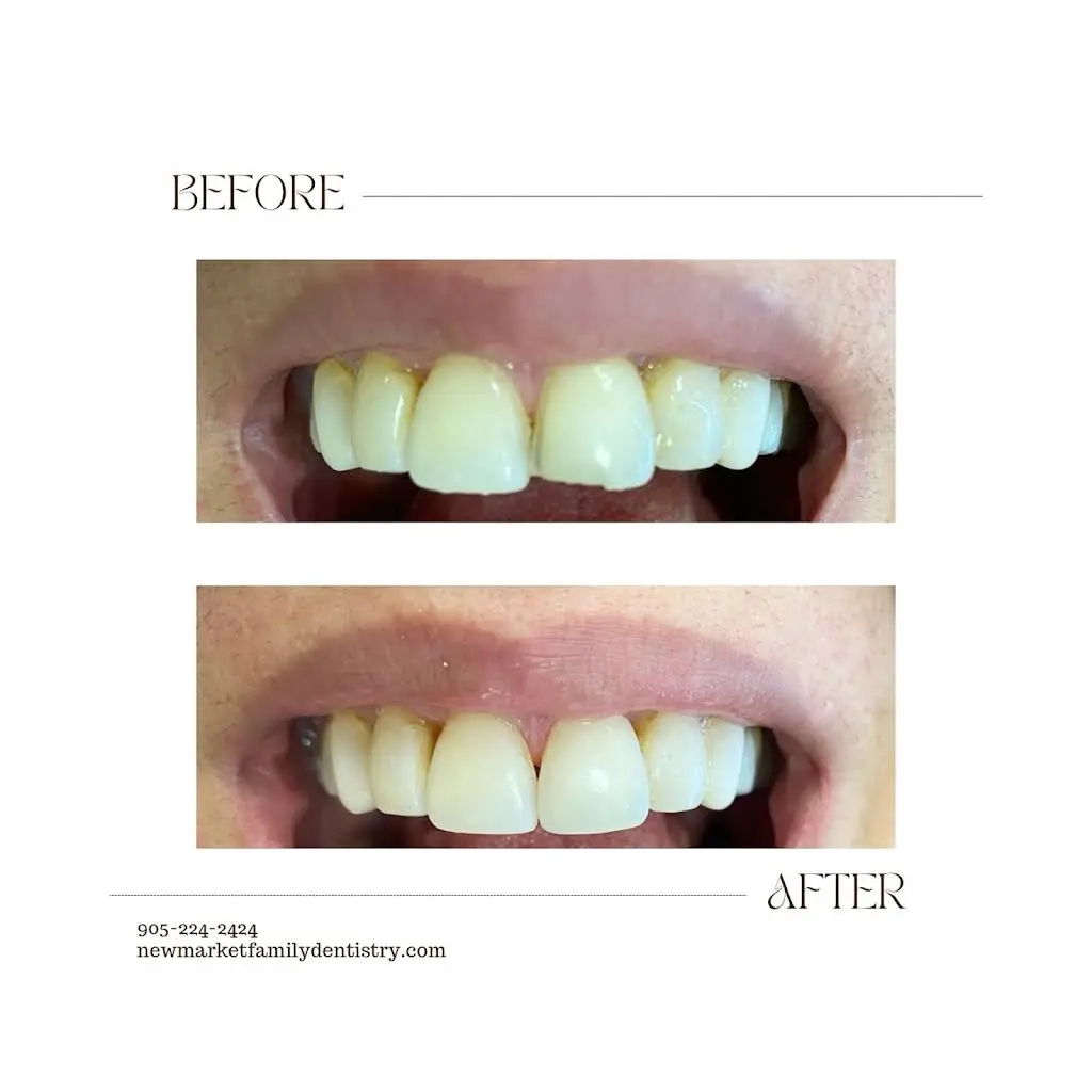 Newmarket Family Dentistry