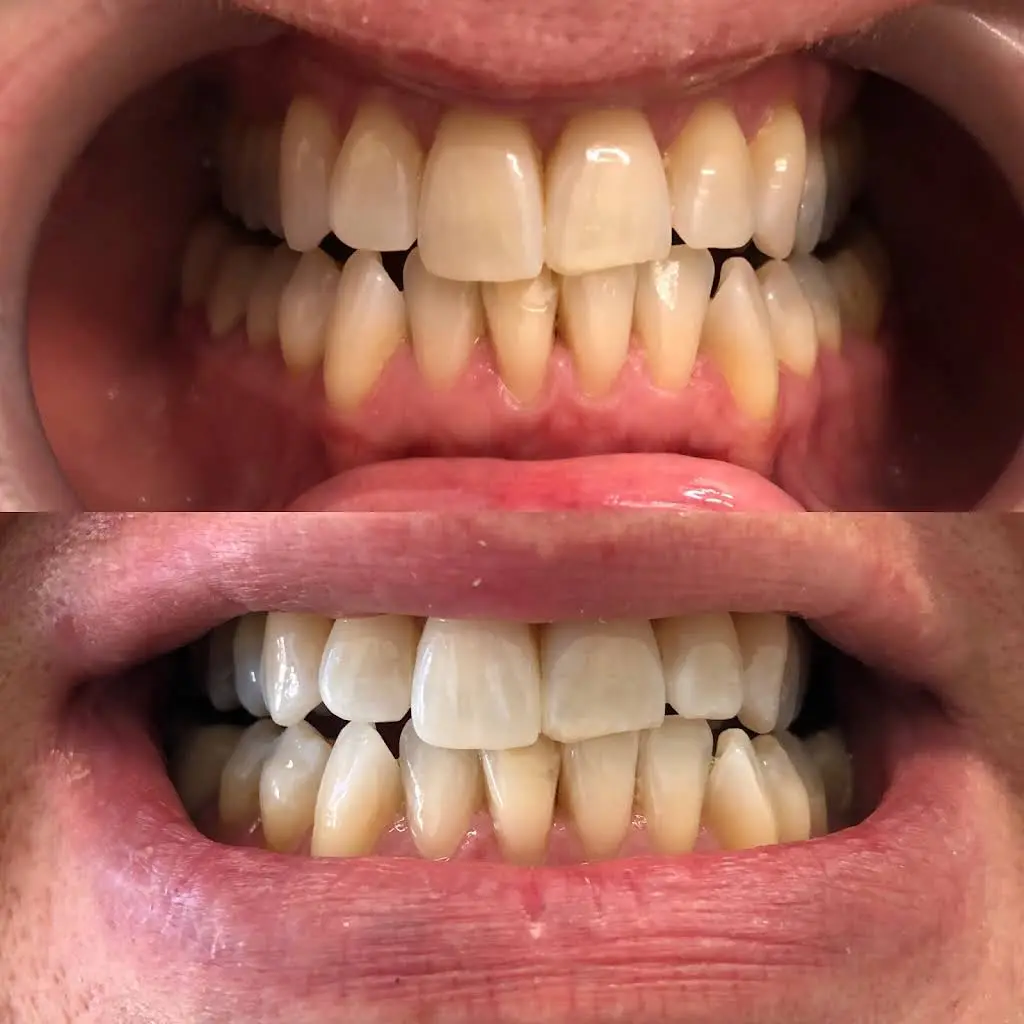 Glow Dental Hygiene Clinic