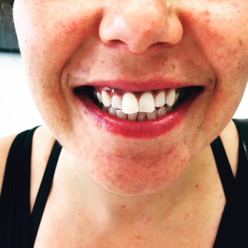 Glow Dental Hygiene Clinic