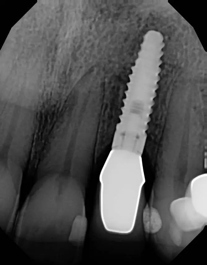 Atkinson Family Dental
