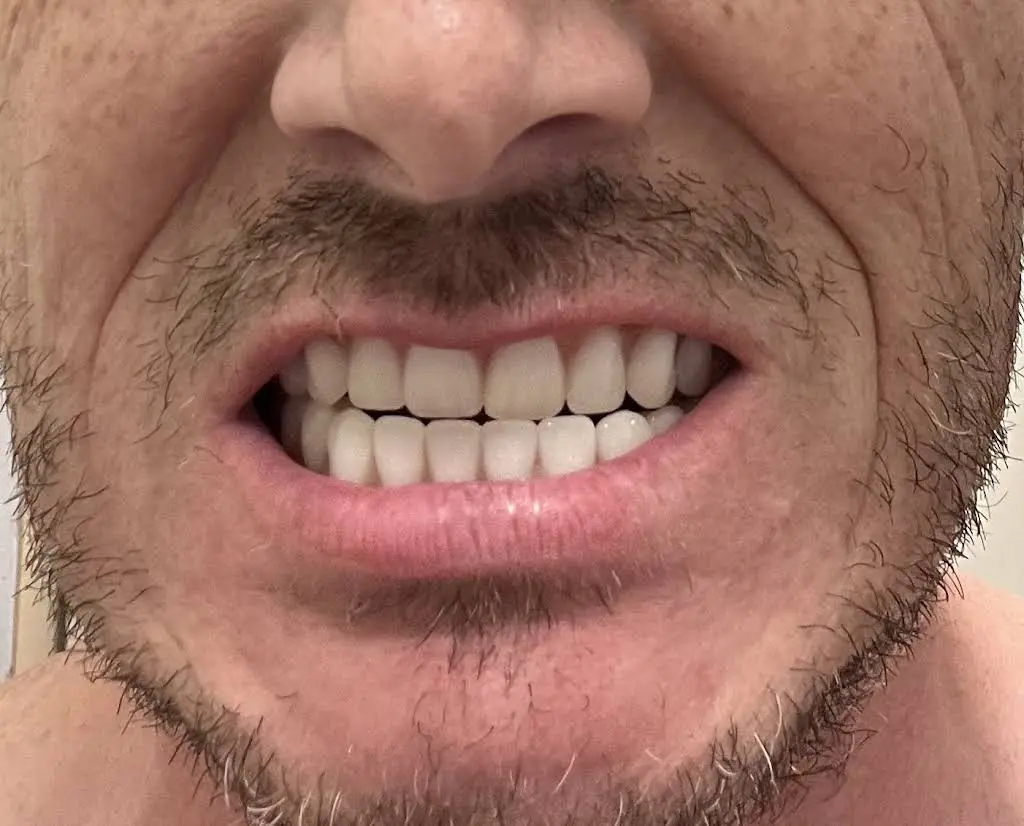 Affordable Dentures & Implants