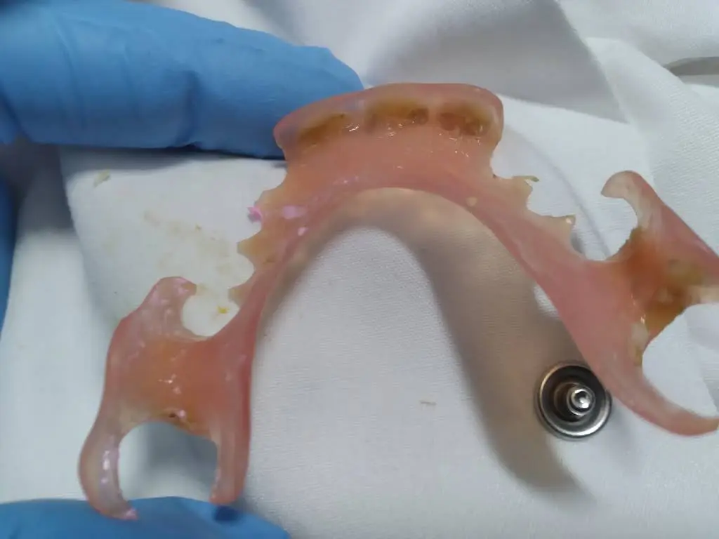 Aspen Dental