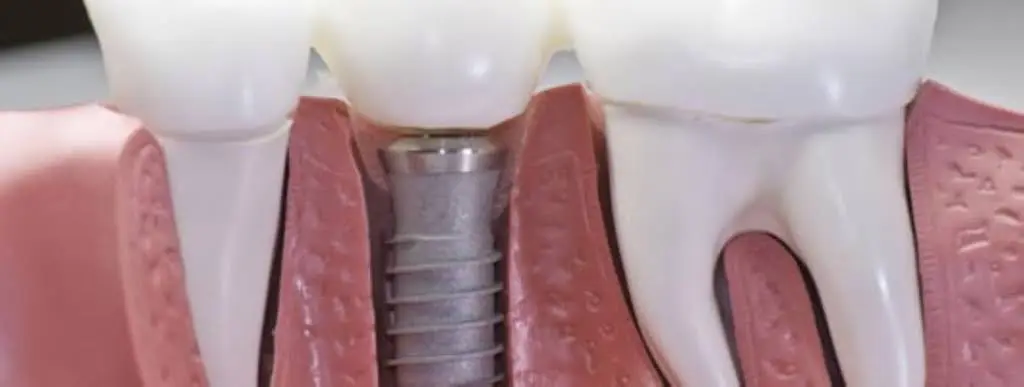 Colerain Denture Center Dr. Timothy J. Richter
