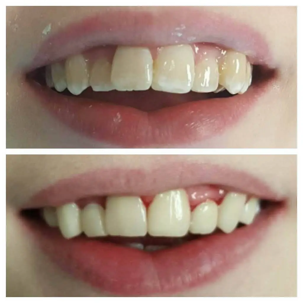 Dent-Al Smiles, LLC