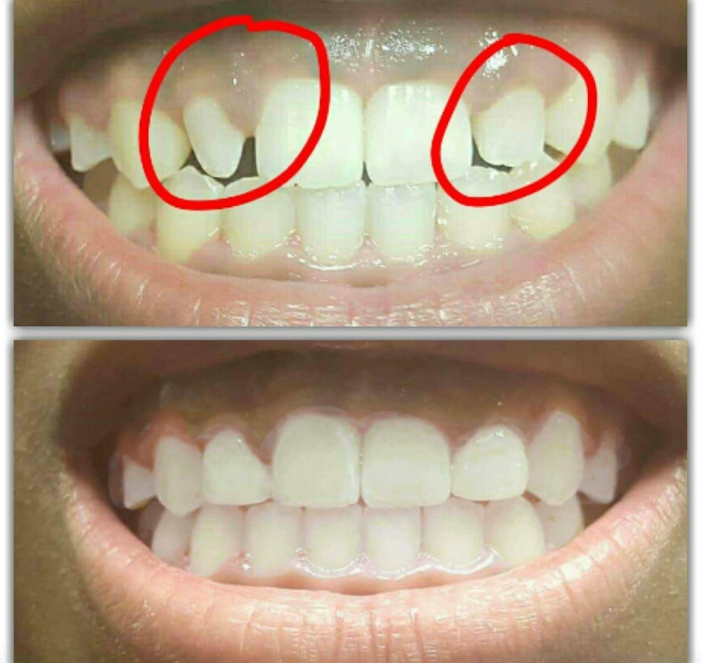 Dent-Al Smiles, LLC