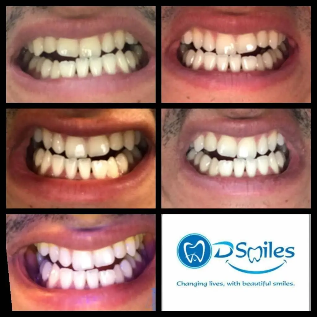 Dent-Al Smiles, LLC