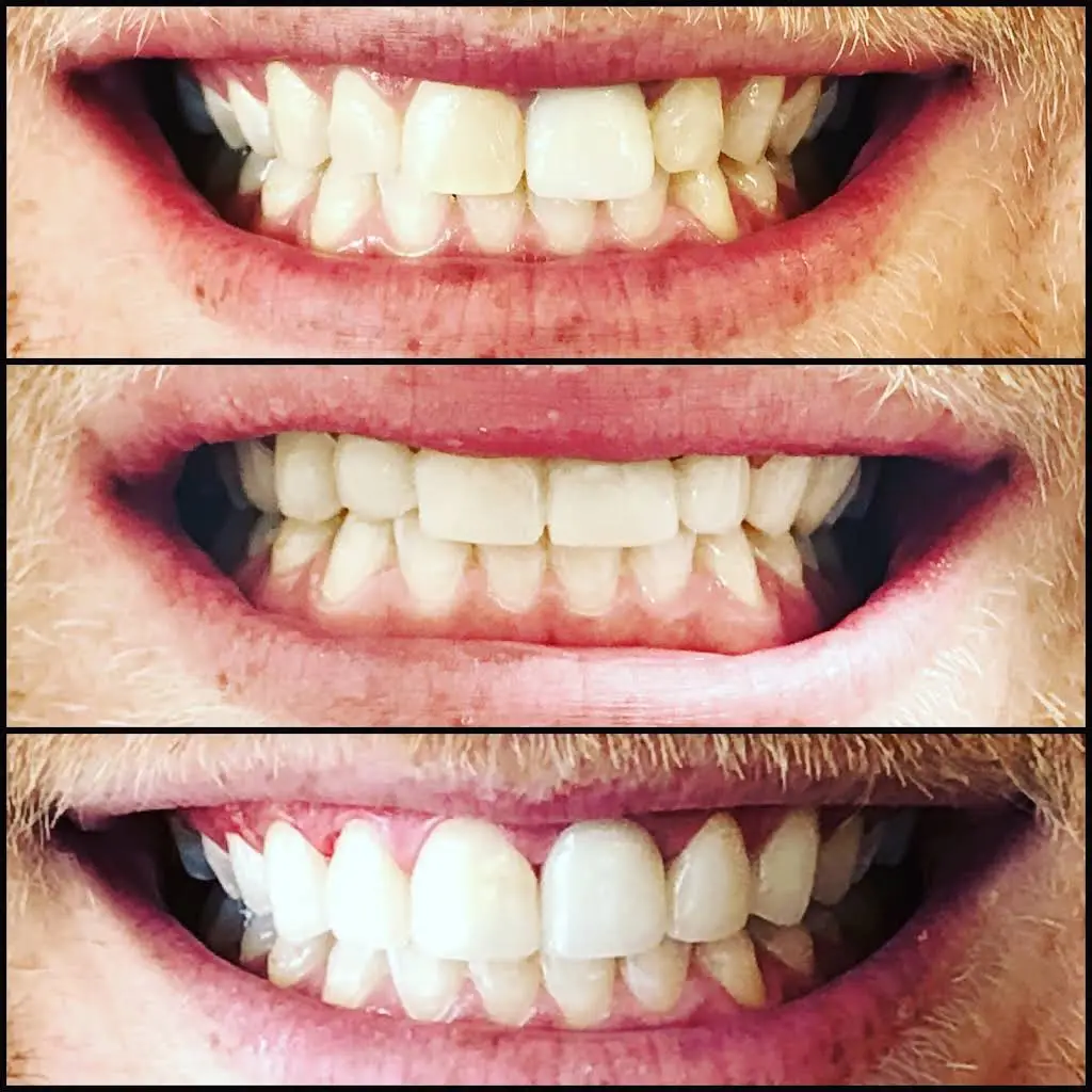 Daily Dental & Bracesbar Dublin