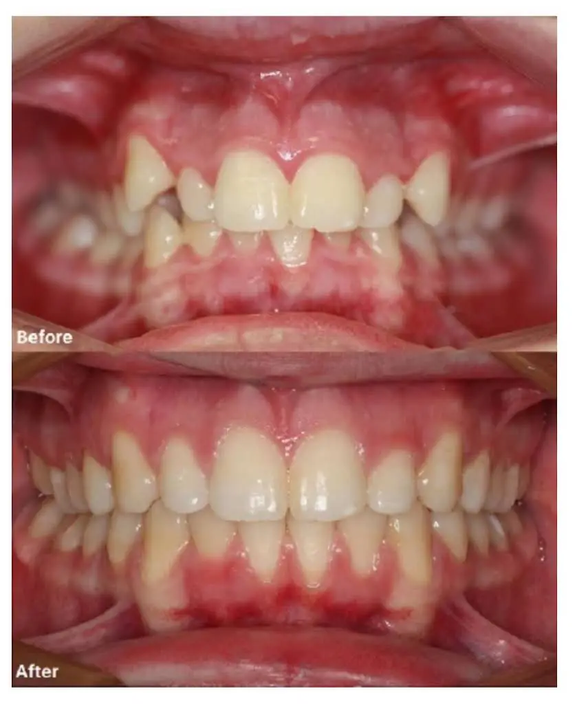 A Winning Smile Orthodontics