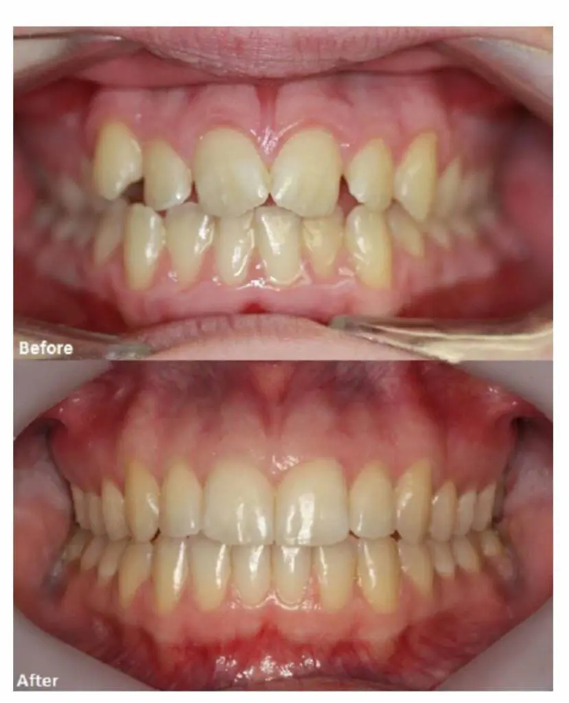 A Winning Smile Orthodontics