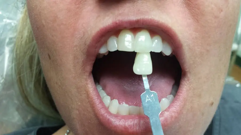 Smiles Ahead Family Dentistry